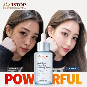 Recommandation de <span class=keywords><strong>vente</strong></span> - Sérum éclaircissant à la niacinamide pour estomper les taches, éliminer les décolorations et corriger les imperfections existantes - Product Image 1