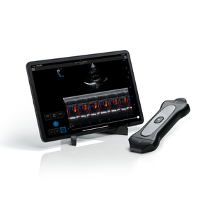 Ecógrafo Portátil para Perros a <span class=keywords><strong>Precio</strong></span> <span class=keywords><strong>de</strong></span> Fábrica Periodmed, Ecógrafo Veterinario Portátil, Sonda <span class=keywords><strong>de</strong></span> Ultrasonido Portátil - Product Image 2