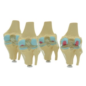 Le fabricant transforme et vend en gros des modèles de genou articulé à quatre étapes de développement ; manuel de chirurgie médicale du genou, des mains et des pieds. - Product Image 3