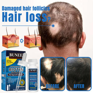 Orgánica biotina Etiqueta Privada milagro venta al por mayor hombre Herbal Romero Rerowth rápido OEM suero de aceite para el crecimiento del cabello para adultos - Product Image 2