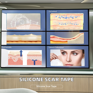 Hot Sale 1.6 X 120 Inch 3M Silicone Removal <strong>Tape</strong> Safe for Spa Use Burn Concealing <strong>Scar</strong> <strong>Tape</strong> for Breast Surgery - Product Image 6