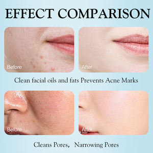 <span class=keywords><strong>โฟม</strong></span><span class=keywords><strong>ล้าง</strong></span><span class=keywords><strong>หน้า</strong></span> MOIKA ดีพ คลีนซิ่ง วิตามิน ไนอะซินาไมด์ <span class=keywords><strong>สำหรับ</strong></span><span class=keywords><strong>ผิว</strong></span><span class=keywords><strong>แพ้</strong></span><span class=keywords><strong>ง่าย</strong></span> ควบคุมความมัน ลดสิว - Product Image 4