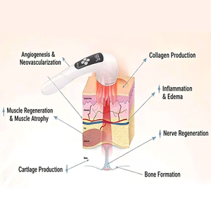 เครื่องเลเซอร์บำบัดสัตว์แบบสองความยาวคลื่น 808 นาโนเมตร สำหรับเนื้อเยื่อชั้นลึก 650 นาโนเมตร สำหรับการรักษาบาดแผล - Product Image 4