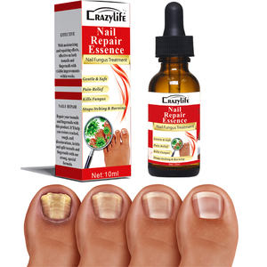 10ml efficace riparazione delle unghie siero essenze Anti fungo rimuovere onicomicosi punta nutriente Logo personalizzato pronto per la spedizione - Product Image 6