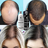 Shampooing et après-shampoing végétaliens à la biotine pour la croissance des cheveux, anti-chute, renforçant la densité, marque privée