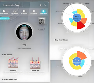 비시아 3600만 화소 피부 분석기 V TWO-S1 3D 스마트 매직 디지털 미러 얼굴 스캐너 피부 분석기 가정용 - Product Image 4