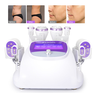 Máquina de cavitación de venta caliente para grasa profunda, cavitación 40k, máquina 4 en 1 para adelgazar el cuerpo y eliminar la celulitis. - Product Image 6