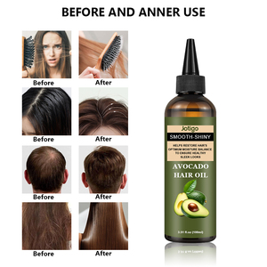 Jotigo all'ingrosso più venduto a base <span class=keywords><strong>di</strong></span> erbe biotina menta piperita Avocado Batana rapida perdita <span class=keywords><strong>di</strong></span> capelli crescono <span class=keywords><strong>olio</strong></span> per la crescita dei capelli selvatici - Product Image 4
