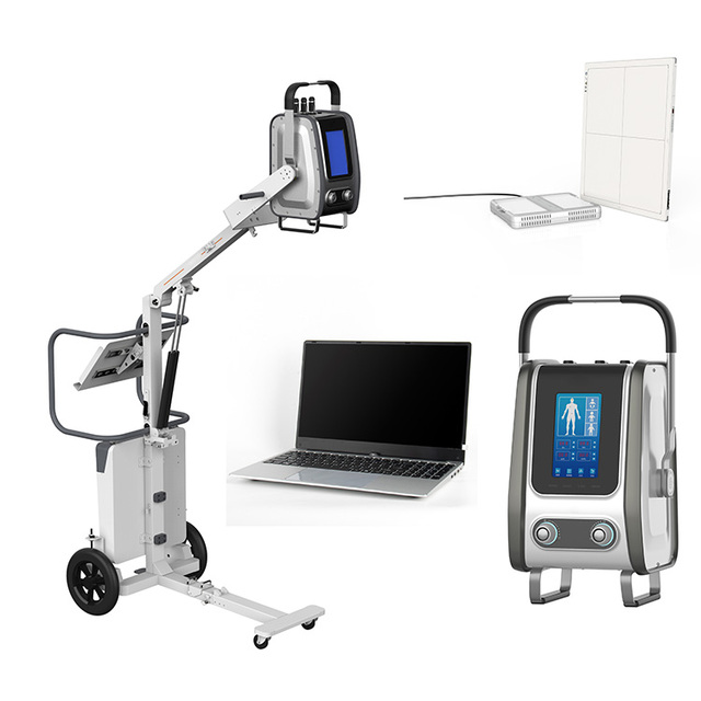 SONTU60 5kw/8kw Portable Digital X-ray Machine Wireless 14*17 FPD