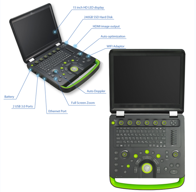 Kanistar Hospital Portable Used Ultrasound Machine Ultrasound Machines B-ultrasonic Diagnostic Equipment