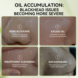 <span class=keywords><strong>Lanbena</strong></span> Removedor de espinillas Máscara de cabeza negra para la nariz Tira de poros Peel Off Cuidado facial espinillas tiras de nariz - Product Image 3