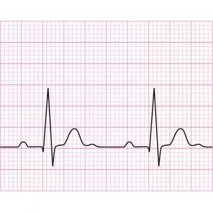 Papel de <span class=keywords><strong>Ecg</strong></span> médico de 12 canales al por mayor papel de carta de 210mm * 20M - Product Image 3