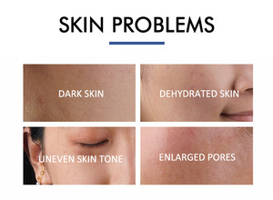 Etiqueta privada Esencia facial Suero Té Polifenoles Extracto <span class=keywords><strong>de</strong></span> <span class=keywords><strong>cafeína</strong></span> Antienvejecimiento Disminución Edema Mejora la opacidad ocular Círculos oscuros Ojo - Product Image 4