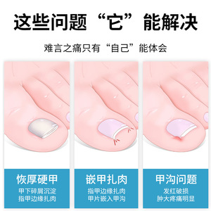 New <b>nail</b> clipper <b>set</b> for ingrown toenails, toenail trimmer, pedicure knife, eagle beak pliers, household needle-mouth <b>nail</b> - Product Image 5