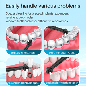 Cabezales de Repuesto para <span class=keywords><strong>Cepillo</strong></span> Interdental Eléctrico, para <span class=keywords><strong>OralB</strong></span>, Recambio para Adultos, Cerdas de Nailon Suaves, Uso en Hoteles, Cuidado Bucal - Product Image 4