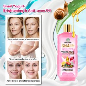 ROUSHUN <span class=keywords><strong>Huile</strong></span> <span class=keywords><strong>essentielle</strong></span> corporelle Yaourt d'<span class=keywords><strong>escargot</strong></span> <span class=keywords><strong>Huile</strong></span> éclaircissante anti-acné pour le visage et le corps - Product Image 4