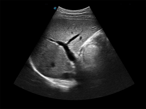 Escáner de Ultrasonido Veterinario <span class=keywords><strong>Sonoscape</strong></span> E1V <span class=keywords><strong>E1</strong></span> y Ultrasonido en Blanco y Negro para Uso Veterinario y Venta para Clínicas y Hospitales de Mascotas - Product Image 4