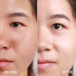 OEM ODM Natural Vegan <span class=keywords><strong>Moringa</strong></span> fermentasi pepaya Toner pengelupasan kulit lembut air pencerah dengan Formula murni - Product Image 4