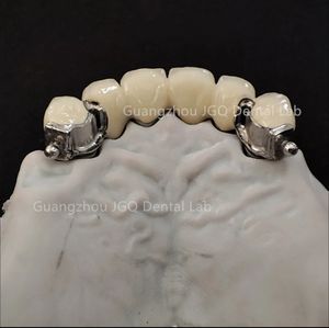Dentaduras postizas totalmente cerámicas Zirconia o dentaduras postizas Pfm Tipos de Diseño Digital en <span class=keywords><strong>Exocad</strong></span> Rápido y eficiente - Product Image 5