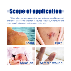 OEM South Moon 6ชิ้นนุ่มระบายอากาศได้ดีลวก<span class=keywords><strong>แผล</strong></span><span class=keywords><strong>ถลอก</strong></span>และรอยขีดข่วนอุปกรณ์เสริมผ้าโปร่ง18*30ซม. - Product Image 6