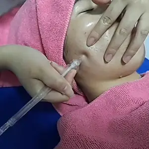 Peeling de chorro de oxígeno y agua para limpieza profunda de la piel para uso clínico y Spa de belleza