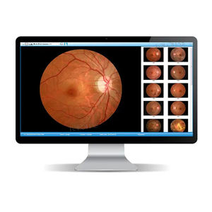 LHV650A oftalmik ekipmanlar Fundus kamera fiyat göz Test makinesi dijital Retin Fundus kamera - Product Image 3