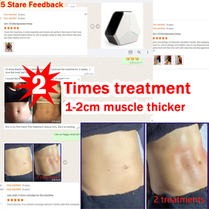 Shefmon Two Handles 9D Mini Inner Ball Roller Cellulite Reduce Inner Ball Roller Machine - Product Image 3