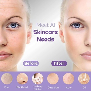 Cepillo de Limpieza Facial 4 en 1 Portátil e Impermeable, Recargable por USB, Herramienta de Silicona para Limpiar Poros, Exfoliante Facial - Product Image 4