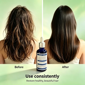 Aceite Capilar Nutritivo a Base de Hierbas al 15%, 60 ml, Tónico Reparador para el Crecimiento del Cabello, Tratamiento para Cabello Seco/Dañado, Biotina Orgánica Hidratante - Product Image 2