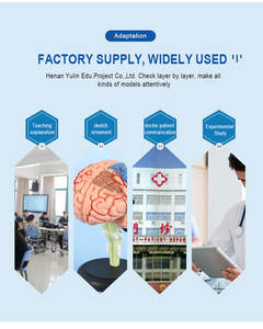 Science médicale de haute qualité et meilleur prix, modèle de <span class=keywords><strong>pathologie</strong></span> de vaisseau sanguin de trombose - Product Image 5