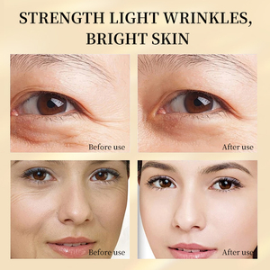 ครีมบำรุงผิวหน้าสำหรับผู้ใหญ่ ลดเลือนริ้วรอย ลดฝ้ากระ ผลิตภายใต้แบรนด์ของลูกค้า (OEM)  ผสมไฮยาลูรอน ช่วยเติมความชุ่มชื้นและปรับผิวให้กระจ่างใส - Product Image 2