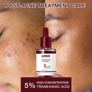 Corrector de Manchas Oscuras de Marca Privada, Ilumina y Unifica el Tono de la Piel, Control de Grasa, 10% Niacinamida, 4% Ácido Tranexámico, Sérum - Product Image 2