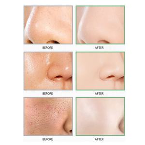 Masque en bâton d'argile au thé vert pour le soin de la peau du visage, contrôle du sébum, réduction des points noirs, logo personnalisé OEM - Product Image 6