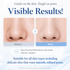 Medicubes Pearl Serum 30mL, Almohadillas Clarificantes para el Rostro, Eliminan Imperfecciones, Paquete de 70 Unidades, Piel Clara - Product Image 4