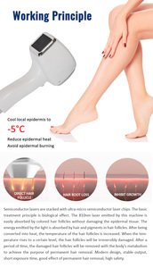 Machine d'épilation au laser diode 808 nm + Nd YAG 2 en 1 haut de gamme 1200 W avec refroidissement par air/eau pour une épilation permanente - Product Image 3