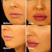 Grossiste Repulpeur Lèvres Gloss Marque Privée Hydratant Transparent Effet Injection