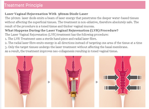 Máquina de ablación térmica para cirugía plástica ginecológica, vaporización de incisión, emulación de haemostasia - Product Image 5
