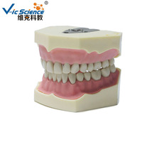 Modelo de estudio dental tipo BF, modelo de dientes de repuesto para tipodonto