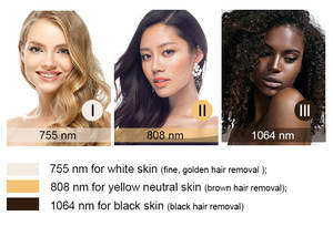 <span class=keywords><strong>Laser</strong></span> Dioda 4 Gelombang Daya Tinggi 808 810nm Medis <span class=keywords><strong>CE</strong></span> Disetujui Mesin <span class=keywords><strong>Laser</strong></span> Pemangkas Rambut <span class=keywords><strong>Laser</strong></span> Dioda Gabungan Serat - Product Image 4