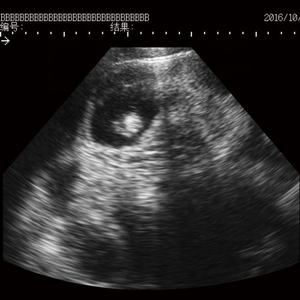 Dengan Harga Murah MSU-2 Penuh Digital Mechanical Sektor Domba Mesin <span class=keywords><strong>Ultrasound</strong></span> - Product Image 5