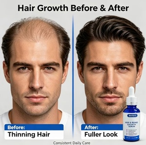 <span class=keywords><strong>Sérum</strong></span> Capillaire Croissance <span class=keywords><strong>Cheveux</strong></span> à la Kératine et Huile d'Argan Formule 5% : Accélère la Repousse des Follicules Dormants, pour des <span class=keywords><strong>Cheveux</strong></span> Plus Denses et Plus Forts, Traitement Hydratant - Product Image 1