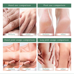 Main orange de vitamine E de citron blanchissant apaisant éclaircissant la crème et la lotion de <span class=keywords><strong>pieds</strong></span> personnalisées - Product Image 2