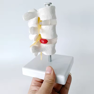 SCIEDU 3 vertebra cakram Lumbar manusia Model anatomi manusia herniasi tulang belakang vertebra dapat dilepas untuk Chiropractor - Product Image 4