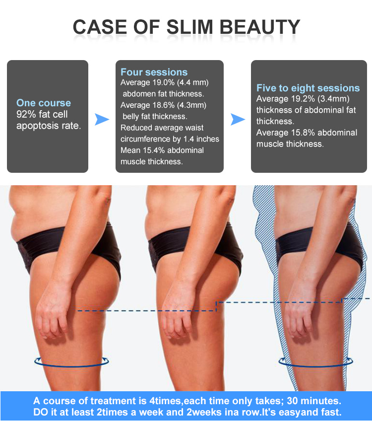EMS Beauty Machine Stimulate Muscle Training Fat Loss Beauty Equipment