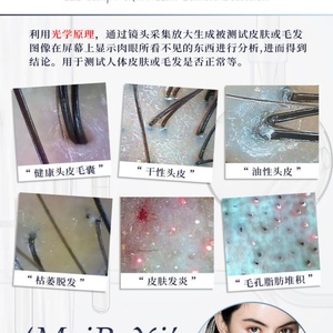 Analyseur portable de peau, cuir chevelu et follicules pileux, nouvelle machine d'analyse de la peau et des cheveux, détecteur HD de cuir chevelu et de cheveux - Product Image 2
