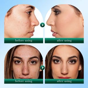 SADOER Private Label Tea <strong>Tree</strong> <strong>Face</strong> Wash Organic Deep Clean Removing Acne Oil Control Moisturizing Whitening Facial Cleanser - Product Image 6