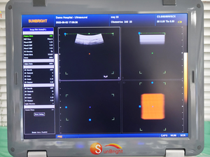 Doppler pulse wave 15 inci Pemasok perangkat medis <span class=keywords><strong>ultrasound</strong></span> 3D rumah sakit - Product Image 4