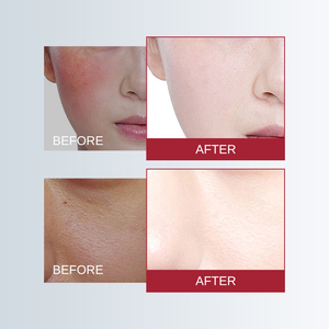Crème Éclaircissante et Unifiante au Glutathion en Gros avec Inhibiteur de Mélanine pour une Peau Éclatante – Produits de Soin Visage - Product Image 6