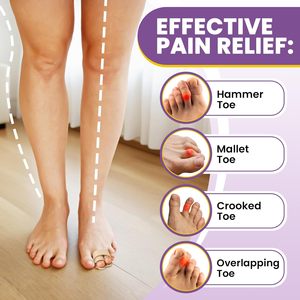 <span class=keywords><strong>Correcteur</strong></span> d'<span class=keywords><strong>orteils</strong></span> Ammer Hammer Toe et <span class=keywords><strong>Correcteur</strong></span> d'hallux valgus pour femmes et hommes, 2 pièces, attelle d'orteil durable et respirante pour <span class=keywords><strong>orteils</strong></span> cassés, croisés ou superposés - Product Image 3