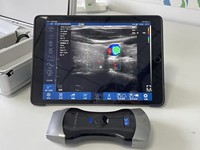 Sonde sans fil 3-en-1 DMU41, appareil d'imagerie de haute qualité à 192 éléments, adapté aux cliniques de médecine générale.